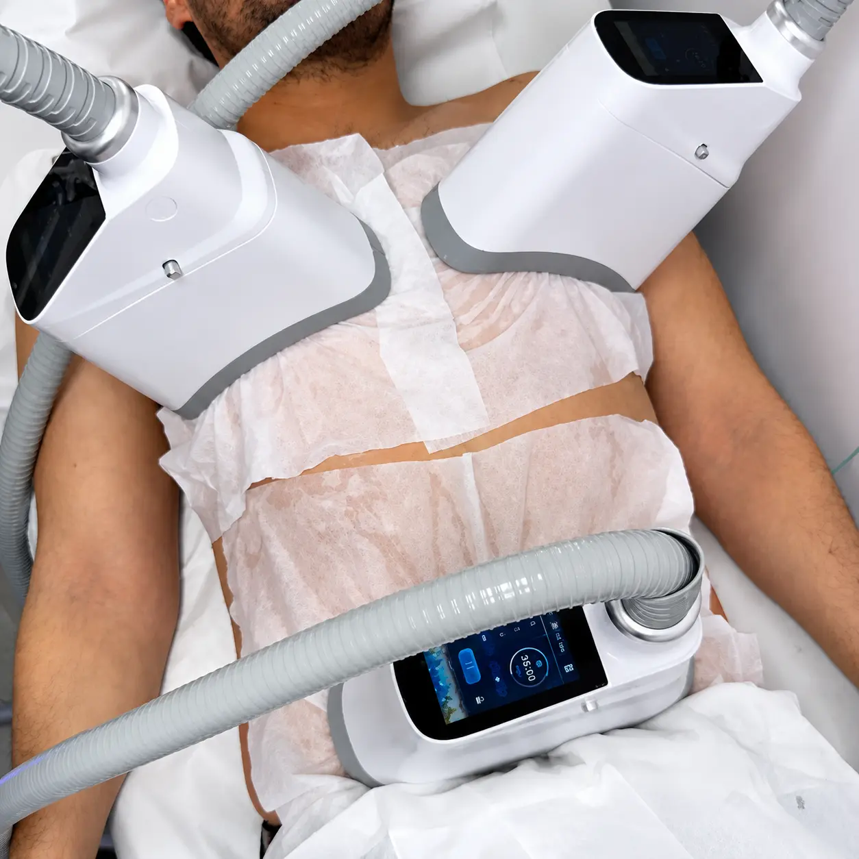 cryobody prime